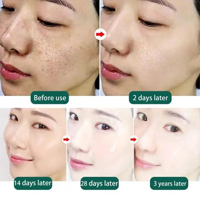 Pore Shrinking Facial Serum Anti Aging Repairing Tightening Moisturizing Blackhead Removal Oil Control Smooth  Korean Cosmetic